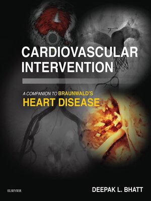 cover image of Cardiovascular Intervention